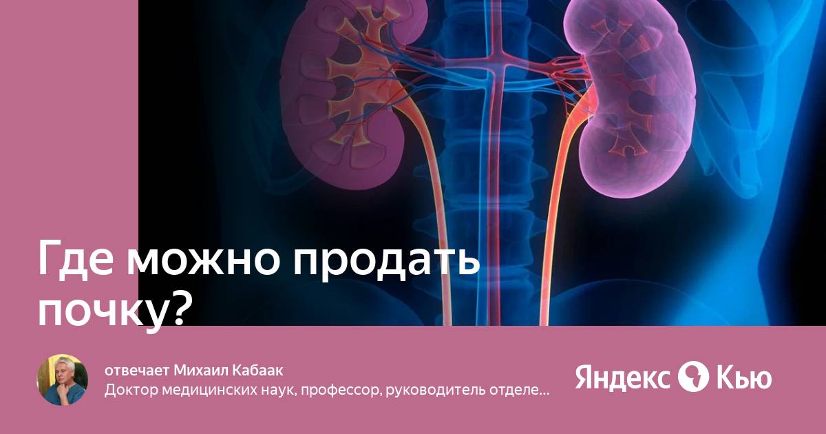 Сколько стоит продать почку 2024. Продать почку. Продай почку. Куда можно продать почку.