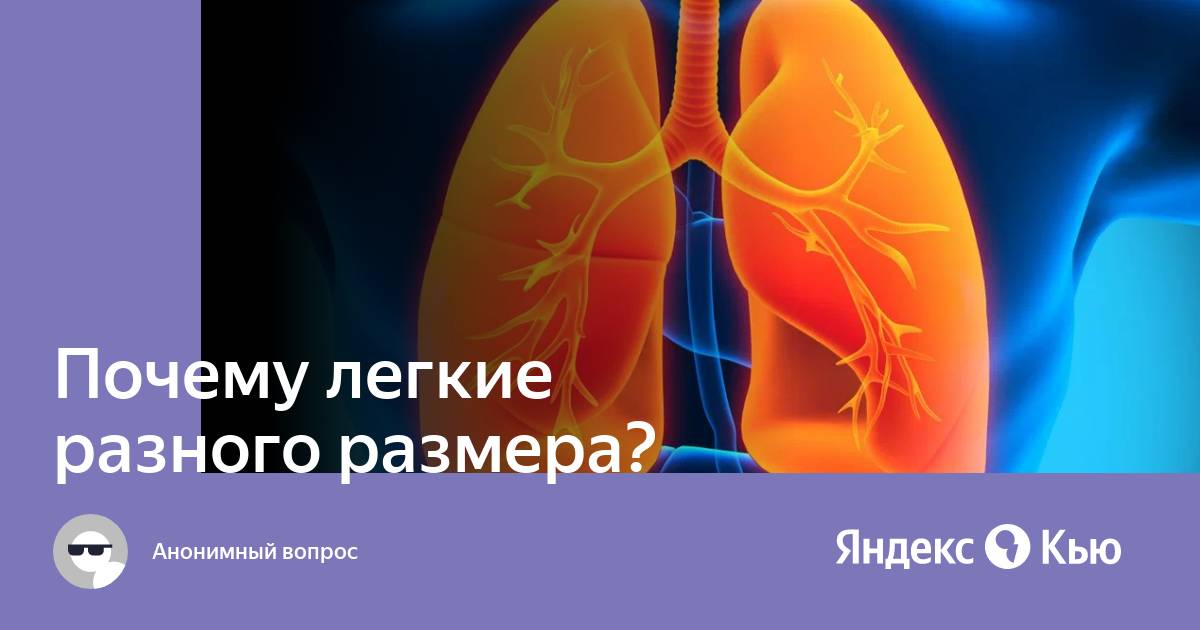 Почему в легких. Скопление жидкости в легком. Правосторонний гидроторакс рентген. Почему в легких. Плевральная пункция при пневмотораксе алгоритм.